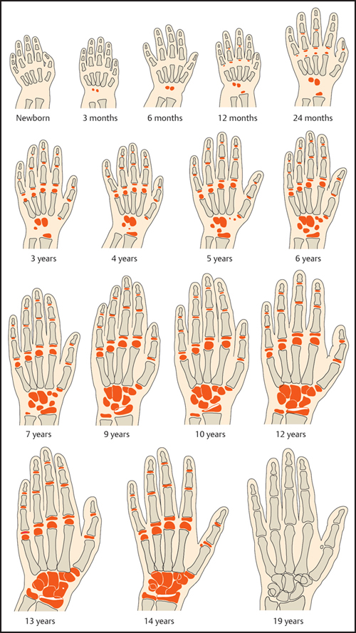 【骨龄≠年龄】为什么医院总测骨龄？(图1)